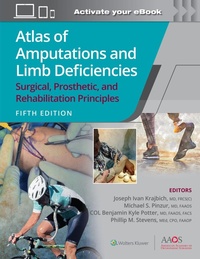 Abbildung von: Atlas of Amputations and Limb Deficiencies 5 - WOLTERS KLUWER HEALTH
