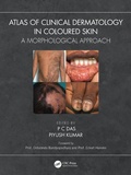 Bild: Atlas of Clinical Dermatology in Coloured Skin - CRC Press
