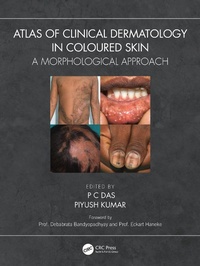 Abbildung von: Atlas of Clinical Dermatology in Coloured Skin - CRC Press