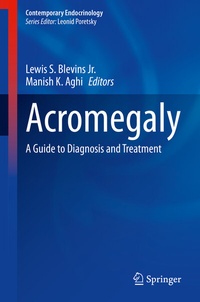 Abbildung von: Acromegaly - Springer