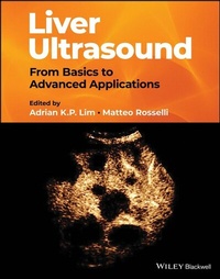 Abbildung von: Liver Ultrasound - Wiley
