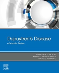 Abbildung von: Dupuytren's Disease - E-BOOK - Elsevier