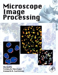 Abbildung von: Microscope Image Processing - Academic Press