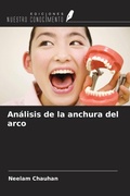 Cover: An&aacute;lisis de la anchura del arco - Ediciones Nuestro Conocimiento