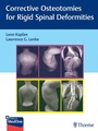 Cover: Corrective Osteotomies for Rigid Spinal Deformities - Thieme