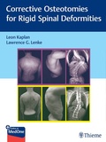 Cover: Corrective Osteotomies for Rigid Spinal Deformities - Thieme