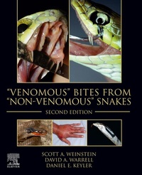 Abbildung von: "Venomous" Bites from "Non-Venomous" Snakes - Elsevier