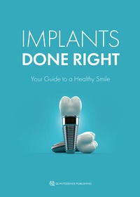 Abbildung von: Implants Done Right - Quintessence Publishing Co, Inc