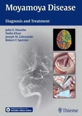 Cover: Moyamoya Disease - Thieme Publishers