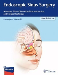 Abbildung von: Endoscopic Sinus Surgery - Thieme Publishers