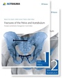 Cover: Fractures of the Pelvis and Acetabulum - Thieme