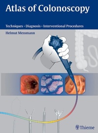 Abbildung von: Atlas of Colonoscopy - Thieme
