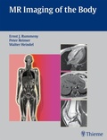Cover: MR Imaging of the Body - Thieme