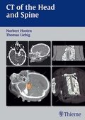 Cover: CT of the Head and Spine - Thieme
