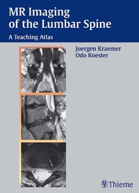 Abbildung von: MR Imaging of the Lumbar Spine - Thieme