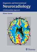 Cover: Diagnostic and Interventional Neuroradiology - Thieme