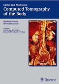 Cover: Spiral and Multislice Computed Tomography of the Body - Thieme