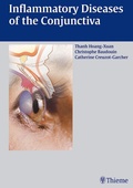 Cover: Inflammatory Diseases of the Conjuctiva - Thieme