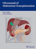 Cover: Ultrasound of Abdominal Transplantation - Thieme