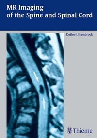 Abbildung von: MR Imaging of the Spine and Spinal Cord - Thieme