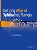 Cover: Imaging Atlas of Ophthalmic Tumors and Diseases - Springer