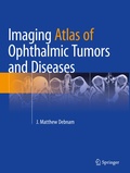Cover: Imaging Atlas of Ophthalmic Tumors and Diseases - Springer