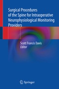 Cover: Surgical Procedures of the Spine for Intraoperative Neurophysiological Monitoring Providers - Springer