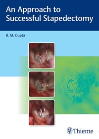 Enlarge image Cover: An Approach to Successful Stapedectomy - Thieme