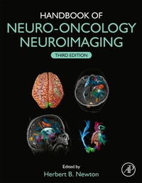 Abbildung von: Handbook of Neuro-Oncology Neuroimaging - Academic Press