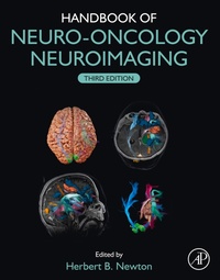 Abbildung von: Handbook of Neuro-Oncology Neuroimaging - Academic Press