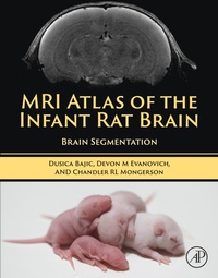 Abbildung von: MRI Atlas of the Infant Rat Brain - Academic Press