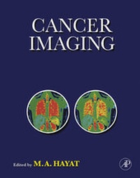 Abbildung von: Cancer Imaging - Academic Press