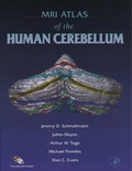 Cover: MRI Atlas of the Human Cerebellum - Academic Press