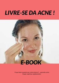 Abbildung von: Livre-se da Acne - Bibliomundi