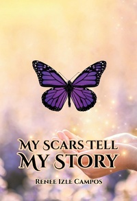 Abbildung von: My Scars Tell My Story - Covenant Books, Inc.