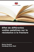 Cover: Effet de diff&eacute;rentes vo&ucirc;tes palatines sur la r&eacute;sistance &agrave; la fracture - Editions Notre Savoir