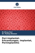 Cover: Peri-Implantat-Erkrankungen, Implantat, Periimplantitis - Verlag Unser Wissen
