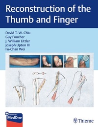 Enlarge image Cover: Reconstruction of the Thumb and Finger - Thieme Publishers