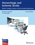 Abbildung von: Hemorrhagic and Ischemic Stroke - Thieme Publishers