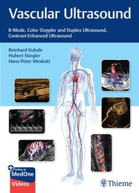 Abbildung von: Vascular Ultrasound - Thieme