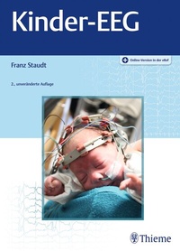 Abbildung von: Kinder-EEG - Thieme