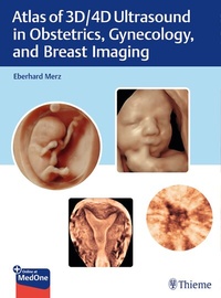 Abbildung von: Atlas of 3D/4D Ultrasound in Obstetrics, Gynecology, and Breast Imaging - Thieme