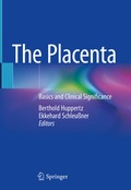 Abbildung von: The Placenta - Springer