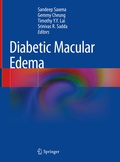 Cover: Diabetic Macular Edema - Springer