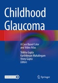 Cover: Childhood Glaucoma - Springer