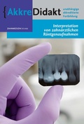 Cover: Interpretation zahnmedizinischer R&ouml;ntgenaufnahmen - Prelum