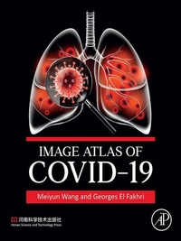 Bild: Image Atlas of COVID-19 - Academic Press