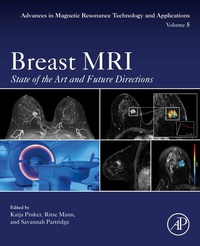 Abbildung von: Breast MRI - Academic Press