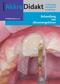 Cover: Behandlung von Abrasionsgebissen - Prelum