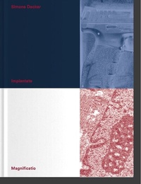 Abbildung von: Simone Decker. Implantate. Magnificatio. - König, Walther
